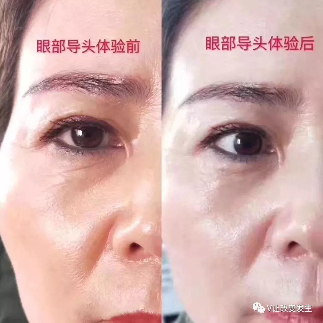 NU SKIN Lumispa眼部全面护理导头使用效果对比&净肤露Q&A！