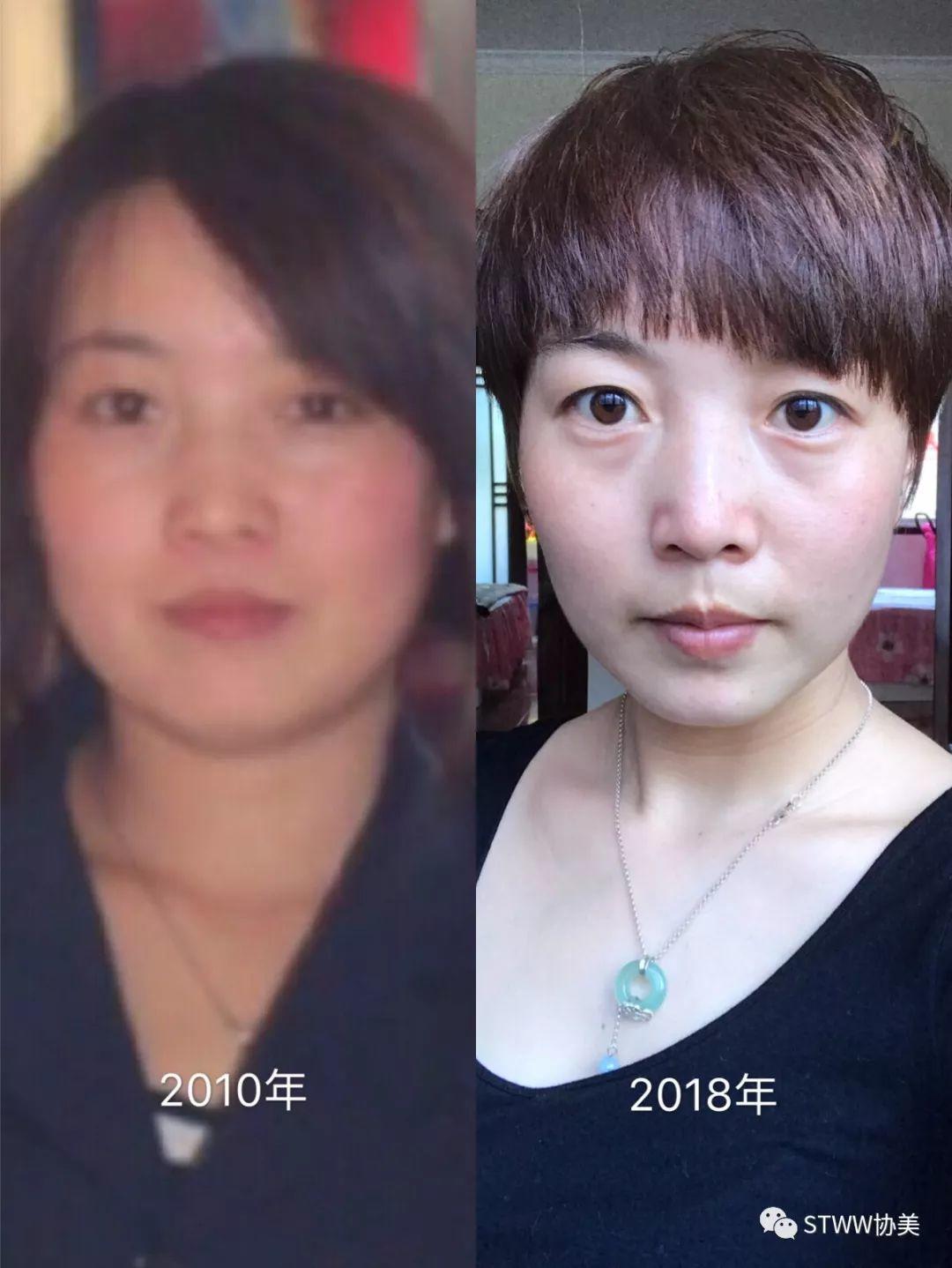 【每日一星】包子脸蜕变 12岁孩子的辣妈--李慧