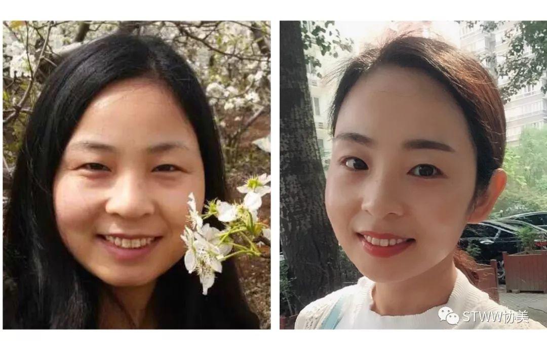 【每日一星】白衣天使到白天鹅的蜕变之路--李海云 ️