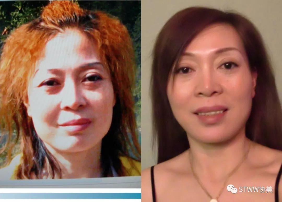 【每日一星】如新让整形医生妈妈变女儿--刘佩卿