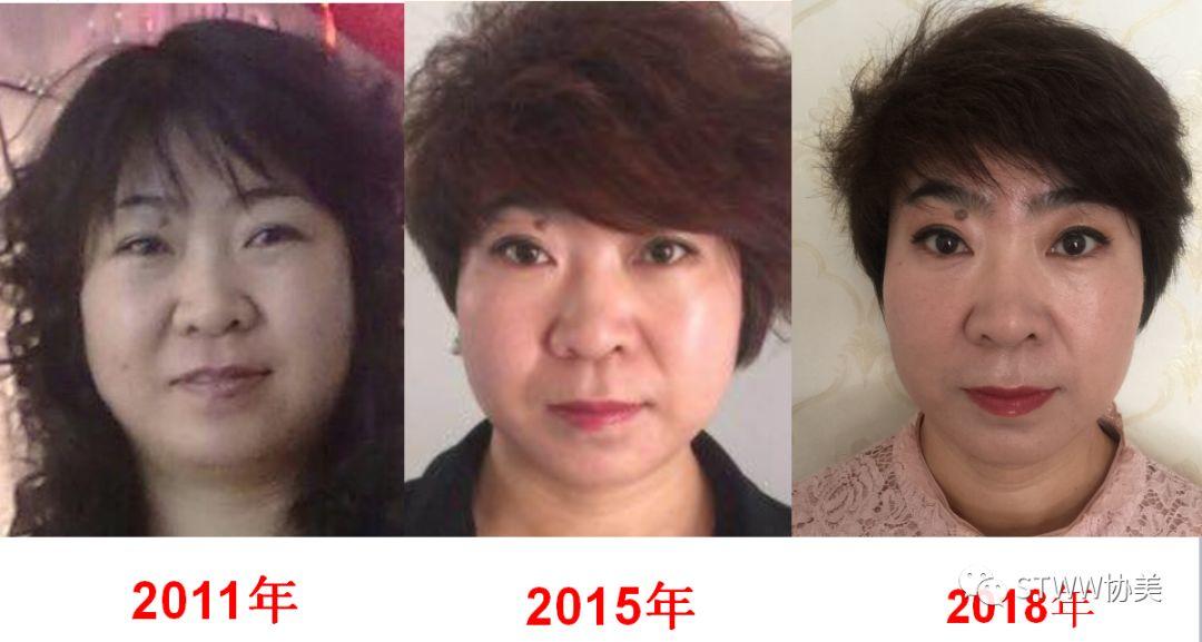 【每日一星】如新让我拥有破茧而出的美丽--孟玉霞