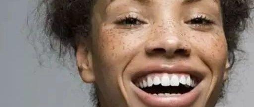 脸上长斑如何解决，NU SKIN还肌肤一份“清白”！