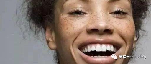 脸上长斑如何解决，NU SKIN还肌肤一份“清白”！