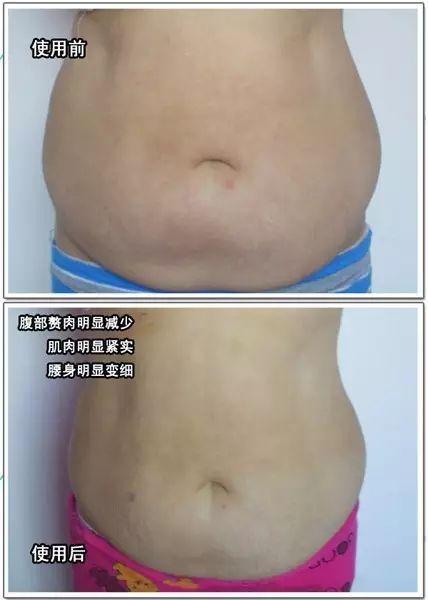 NU SKIN ageLOC spa机超多见证，以后再也不要问我是不是P的图啦！