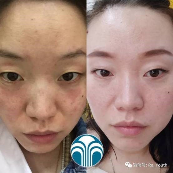 【每日一星】一瓶补水喷雾引发的故事--魏雯