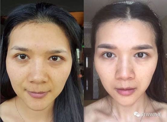 【每日一星】我可以一辈子做超模--张婕竑